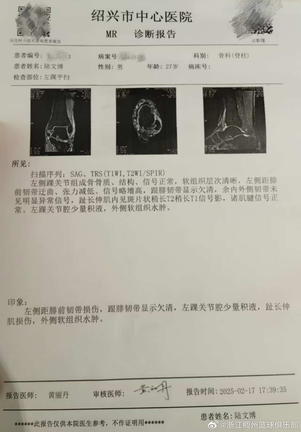 通过这种模